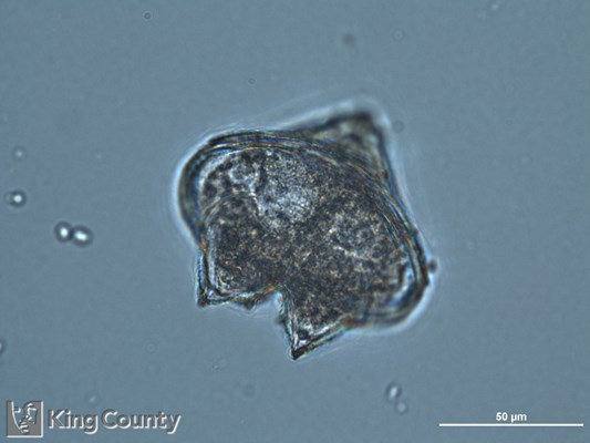 Photo of Protoperidinium conicum/Protoperidinium leonis
